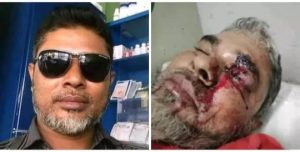 গুরুতর আহত মাই টিভি’র কুলিয়ারচর ও বাজিতপুর প্রতিনিধি কাইয়ুম হাসানের সুস্থতা কামনায় সাংবাদিক সমাজ