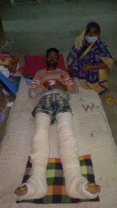 ছাতকে পূর্ব শত্রুতার জেরে যুবকের উপর হামলা, ভেঙ্গে দিলো দুই পা: যন্ত্রনায় কাতরাচ্ছে হাসপাতালে