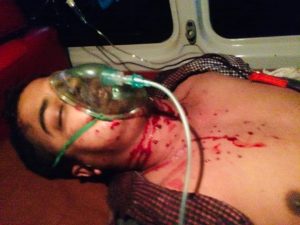 নোয়াখালীর কোম্পানীগঞ্জে সংঘর্ষ, গুলিবিদ্ধ সাংবাদিকের অবস্থা আশঙ্কাজনক, উন্নত চিকিৎসার জন্য ঢাকায় প্রেরন