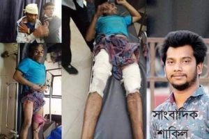 ঠাকুরগাঁয়ে সাংবাদিক শাকিলের পরিবারের ওপর হামলা, দোষীদের গ্রেফতার ও বিচারের দাবি বিএমএসএফ’র