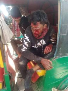 গাছের সাথে ধাক্কা লেগে মোটর সাইকেল চালক নিহত