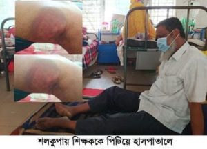 শৈলকুপায় শিক্ষককে পিটিয়ে হাসপাতালে :-