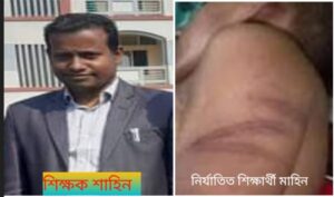 ছাতকে গাছের ডাল ও জুতা দিয়ে শিক্ষার্থীকে নির্যাতন করলেন শিক্ষক।।